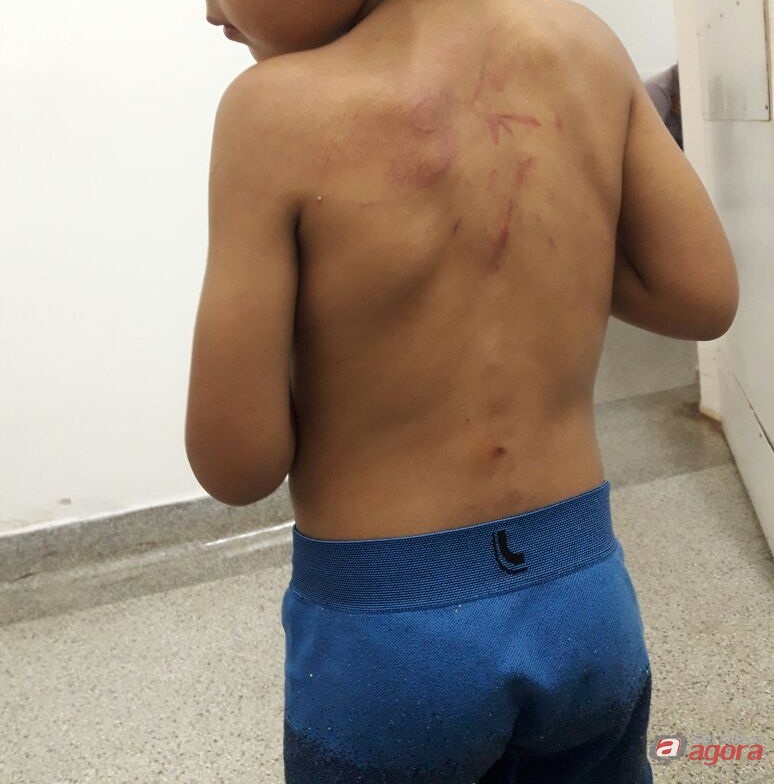 Padrasto é acusado de espancar criança de 3 anos no Prolongamento do Jardim Medeiros -