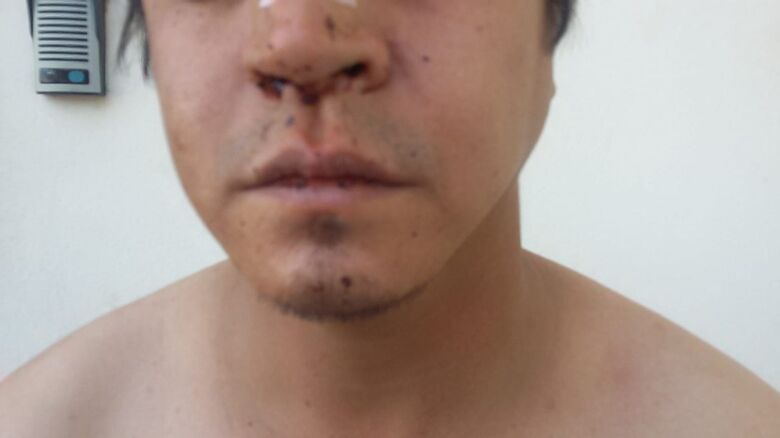 Homem alega que foi agredido por seguranças de casa de shows - Crédito: Luciano Lopes