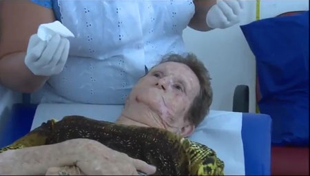 Em São Carlos: o carinho e cuidado de quem trata alguém pelo nome - Câncer de pele (não melanoma) tratado por terapia fotodinâmica - Crédito: Rui Sintra