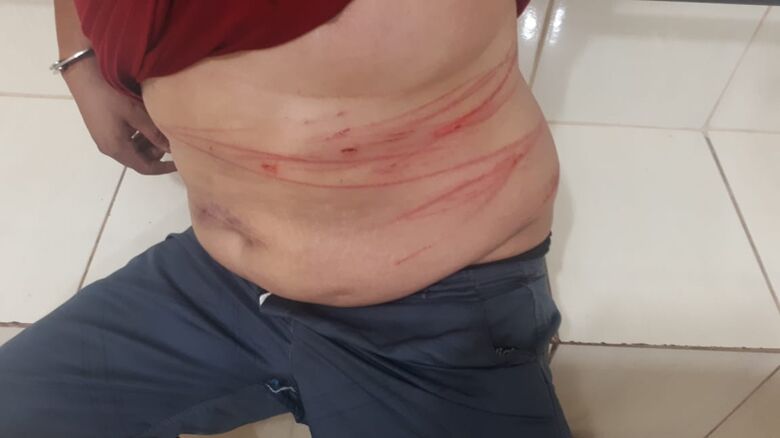 Casal é detido após agressões com facas no Planalto Verde -