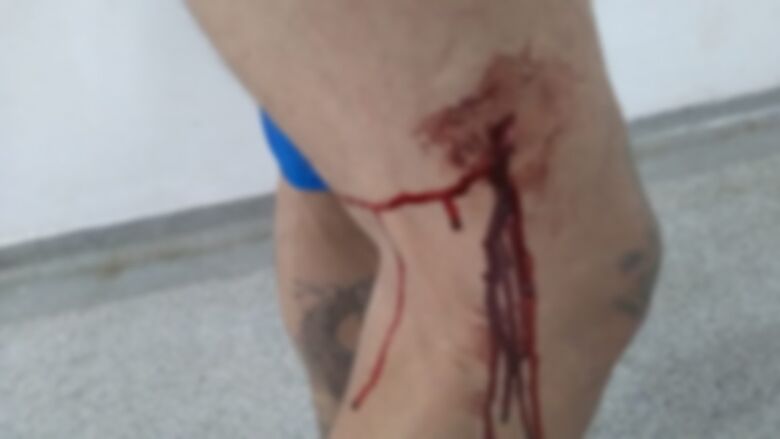 Casal é agredido por familiares no Cidade Aracy - Crédito: Arquivo Pessoal