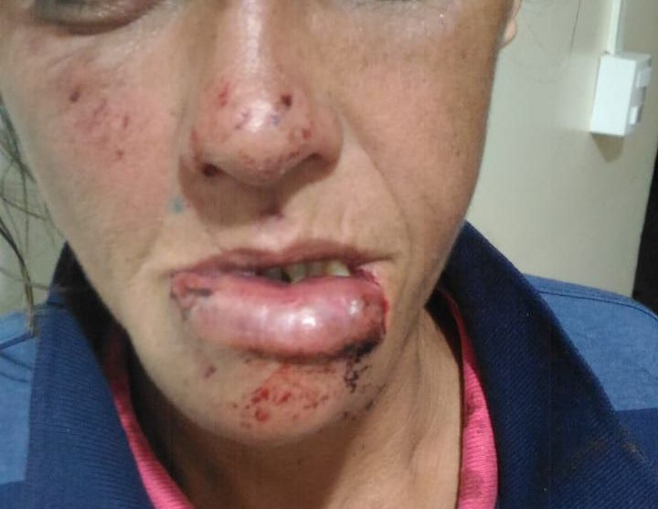 Dona de casa é agredida com socos na boca pelo companheiro - Crédito: Arquivo/SCA