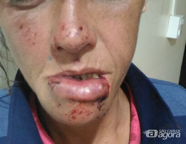 Dona de casa é agredida com socos na boca pelo companheiro - Crédito: Arquivo/SCA