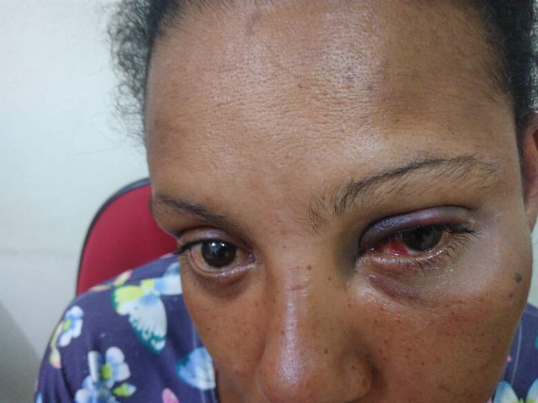Gestante é agredida pelo companheiro com socos e chutes na cabeça - Crédito: Arquivo/SCA