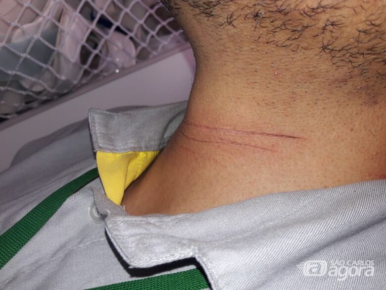 Linha com cerol fere motociclista no Monte Carlo; três ferimentos no pescoço - Crédito: Maycon Maximino