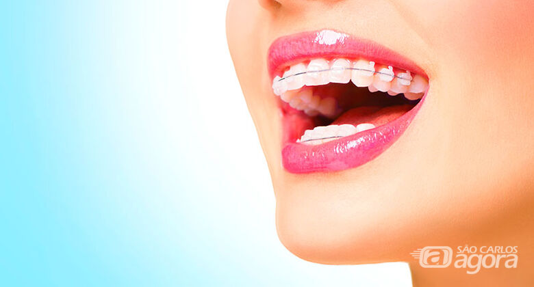 Curso de Especialização em Ortodontia SBG, seleciona pacientes que necessitam de aparelhos nos dentes - Crédito: Divulgação
