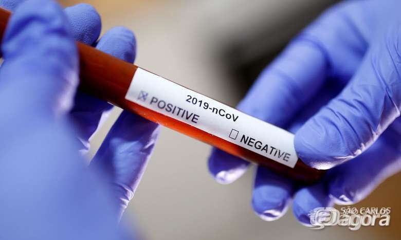 Vigilância Epidemiológica realiza terceira capacitação sobre atendimento de casos suspeitos de coronavírus - Crédito: Divulgação