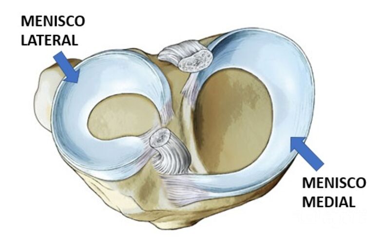 Lesão no menisco é uma das cirurgias ortopédicas mais comuns - 