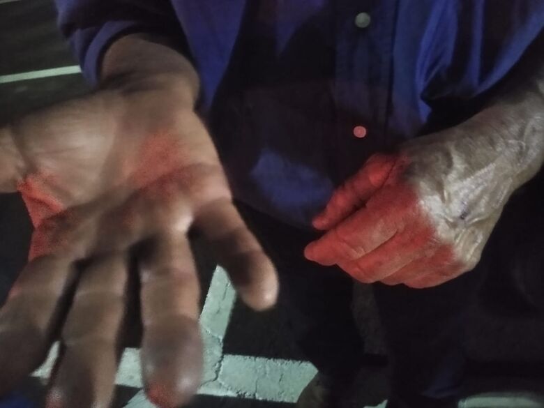Idoso é agredido com pedaço de pau no Bela Vista - Crédito: Luciano Lopes